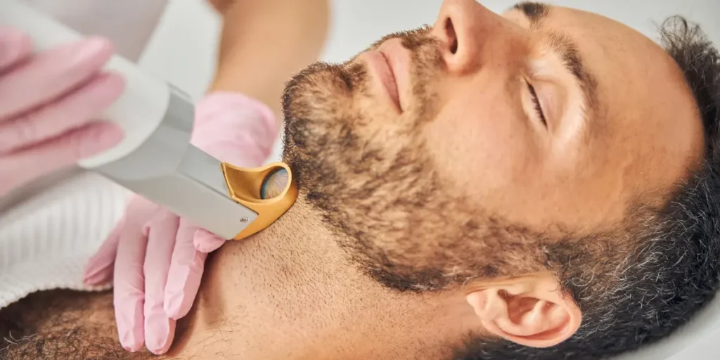 Barba feita ou desenhada? Como a depilação a laser ajuda a manter o estilo Barba feita ou desenhada